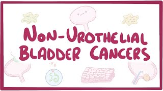 Non-urothelial cell bladder cancers - causes, symptoms, diagnosis, treatment, pathology