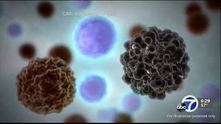 Stanford Health Care Offers New Immunotherapy for Lymphoma