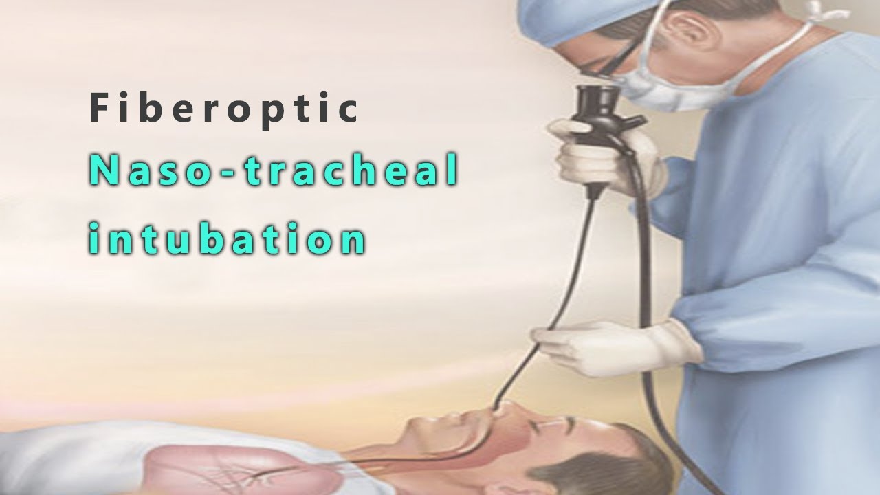 Fiberoptic Nasotracheal Intubation - YouTube