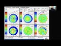 Cases in Corneal Tomography