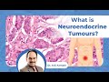 What is Neuroendocrine Tumours | Symptoms and Treatment | Healius Cancer & Hematology Clinics