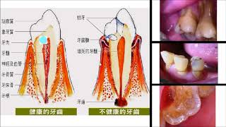 49   醫藥人 楊幽幽 牙痛的源頭— 我的牙為什麼很痛? Editor-in-chief Online Journal of Dentistry \u0026 Oral Health