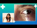 cataracts explained what you need to know by dr. supriya sriganesh