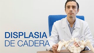 Displasia de Cadera: causas y tratamiento