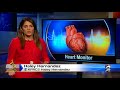 new way to catch irregular heart beats