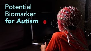 Science Talk: Brainwave Test Could Improve Autism Diagnosis and Classification