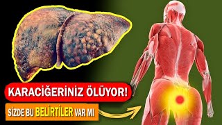 Karaciğerinizin Hasta Gösteren 12 Belirti | karaciğer hastalığı belirtileri | karaciğer yağlanması