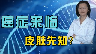 癌症来临皮肤先知？皮肤哪三个变化说明癌细胞突击？