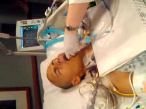 Breathing Tube Removal Youtube