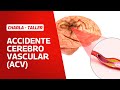 Taller: Accidente Cerebrovascular (ACV) 2023. [Isquémico o hemorrágico]