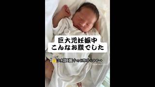 産む前の方が大変でした#巨大児 #赤ちゃん#男の子ベビー#妊婦#出産