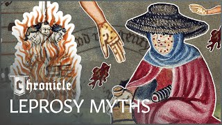 How Syphilis And Leprosy Ravaged The Medieval World | Medieval Dead | Chronicle