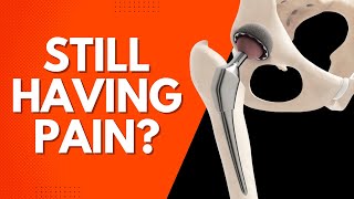 Lingering Pain After a Total Hip Replacement?