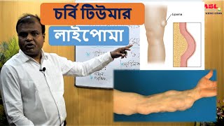 লাইপোমা বা চর্বি টিউমার | Lipoma or fat tumor Bangla | Dr Abdul Mannan