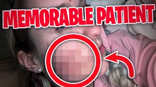 The most Memorable Patients on Dr. Pimple Popper! (THEY WENT CRAZY!)🤪