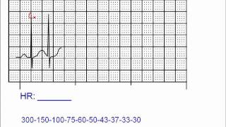 Heart Rate Calculation Exercises