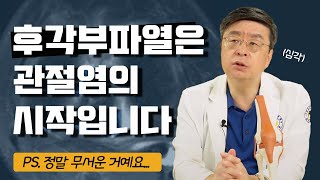 무릎연골찢어짐, 반월상연골판 후각부파열은 한국인의 퇴행성관절염 시작점이다?!