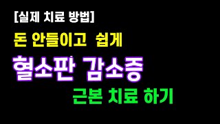 혈소판 감소증 치료 방법 / 자주 멍이 들때 / 쉽게 멍이 들때 / 괜히 피곤해 질때