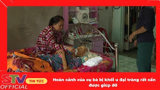 STV - Hoàn cảnh của cụ bà bị khối u đại tràng rất cần được giúp đỡ