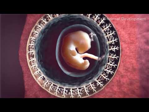 What is the name of the tube that links the placenta to the fetus?