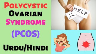 Polycystic Ovary Syndrome(PCOS)| Symptoms| Causes| Treatment| Urdu, Hindi
