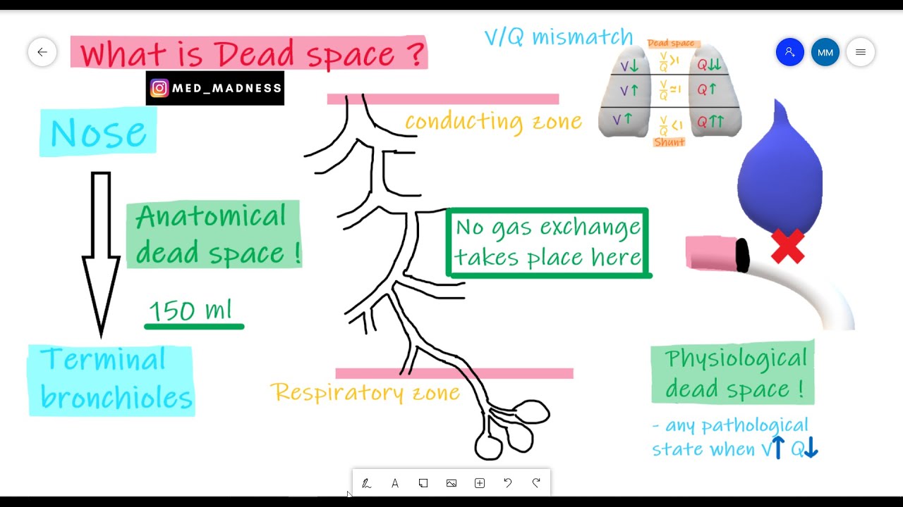 What Is Dead Space ? | RS Physiology | Med Madness - YouTube