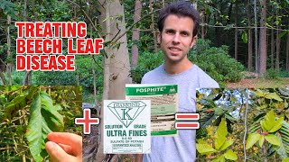 How to Treat Beech Leaf Disease