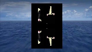 Bones - GladWeHaveAnUnderstanding (Prod. By Dylan Brady)