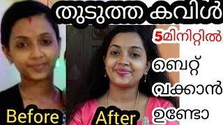 തുടുത്തകവിൾ കിട്ടാൻ5മിനിറ്റ് |5കാര്യങ്ങൾ25വട്ടം ചെയ്യു എത്ര ഒട്ടിയ കവിളും തുടുത്തകവിൾ #chubbycheeks