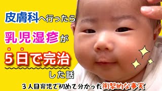 【乳児湿疹】発症から完治まで/保湿剤は３６５日塗らなくてもいい!?【生後２ヶ月】ロコイド/３児の母