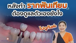 8 วิธีดูแลตัวเอง...หลังทำรากเทียม | รากฟันเทียม By เดนทัลอิมเมจ