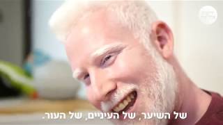 איך נראים חייו של לבקן?