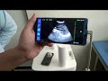 What can I see if I use a BW USB Ultrasound Convex Array Probe