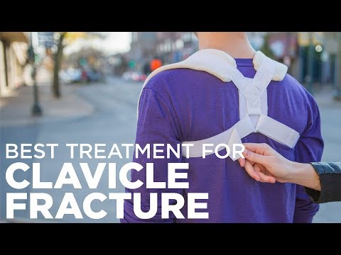 How to Treat a Broken Collarbone with a Clavicle Brace How to Treat a Broken Collarbone with a Clavicle Brace