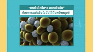 Dr. สุขใจ : ความเย็นสามารถลดเซลล์ไขมันได้