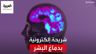 إطلاق الضوء الأخضر لتجربة زراعة شريحة إلكترونية في الدماغ البشري