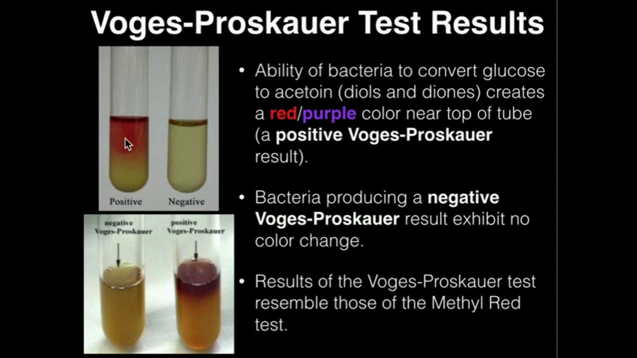 Voges–Proskauer (VP) Test- Principle, Reagents, Procedure, 58% OFF