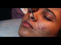 क्या laser hair removal एक permanent solution है permanent hair removal or not clear skin