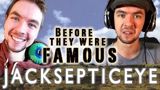 JACK SEPTIC EYE | Before They Were Famous