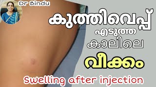 കുത്തിവെപ്പ് എടുത്ത കാലിൽ വീക്കം/Swelling after injection what to do/Dr Bindu childhealth tips