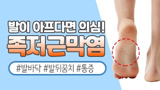 [서울나우병원] 발이 아프시다면 의심! 족저근막염