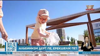 Альбинизм дерт пе, ерекшелік пе?