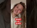 avant vs après short shorts shortvideo beauty style fashion model