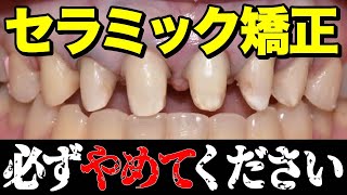 セラミック矯正で後悔する前に必ずこの動画を見てください。