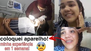 VLOG : COLOQUEI APARELHO ORTODÔNTICO ! TÁ DOENDO? 😰 Por | Thayná Alexandra