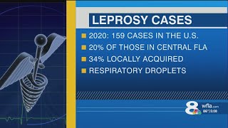 Leprosy could become endemic in Florida as cases rise, CDC says