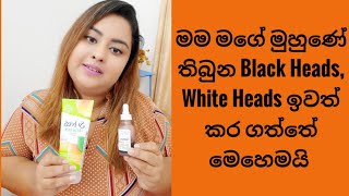 How I Remove Blackheads And Whiteheads | බ්ලැක් හෙඩ් වලට හොදම පහසුම විසදුම | ප්‍රථිපල 100% විශ්වාසයි