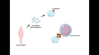 Systemic Lupus: a promising therapeutic opportunity via platelets (Science Translational Medicine)