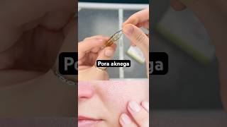 Pora aknega uy sharoitida dovolash #skincare #botoxm #skincareroutine #botoxcosmetic #beauty