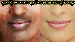 എന്റെ പൊന്നോ ഇത് സംഭവം പൊളിക്കും 😍😍//skin whitening brightening manjishta sheet mask